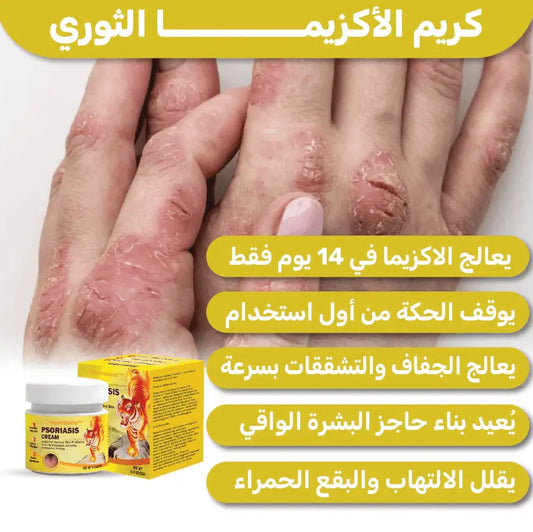 كريم الأكزيما اللي يريحك من أول استعمال